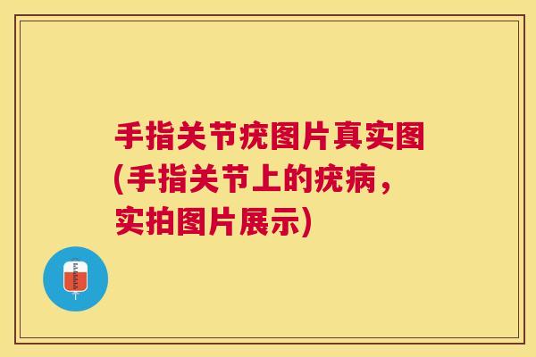 手指关节疣图片真实图(手指关节上的疣病,实拍图片展示)