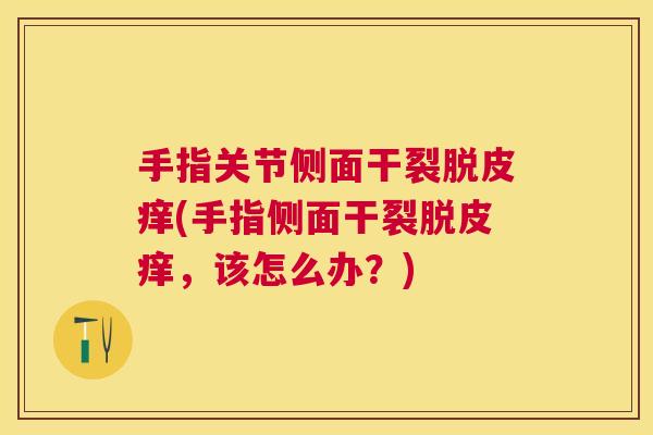 手指关节侧面干裂脱皮痒(手指侧面干裂脱皮痒，该怎么办？)