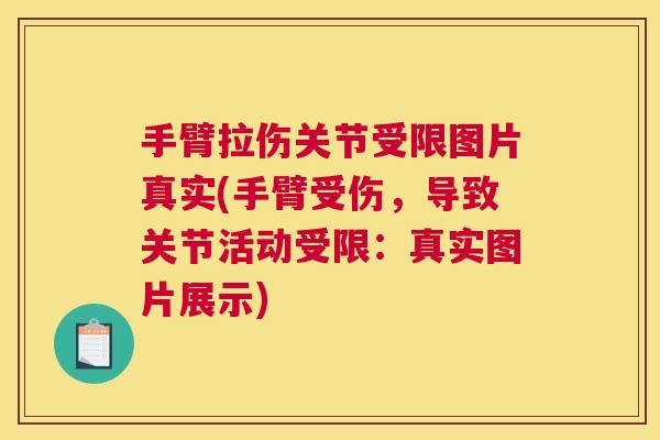 手臂拉伤关节受限图片真实(手臂受伤,导致关节活动受限:真实图片展示) 手臂拉伤关节受限图片真实(手臂受伤,导致关节活动受限:真实图片展示)