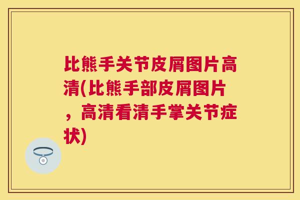 比熊手关节皮屑图片高清(比熊手部皮屑图片,高清看清手掌关节症状)