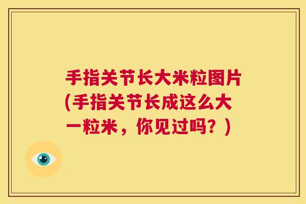 手指关节长大米粒图片(手指关节长成这么大一粒米,你见过吗?)