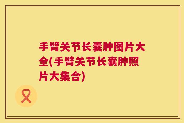 手臂关节长囊肿图片大全(手臂关节长囊肿照片大集合)