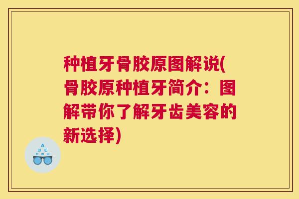 种植牙骨胶原图解说(骨胶原种植牙简介：图解带你了解牙齿美容的新选择)
