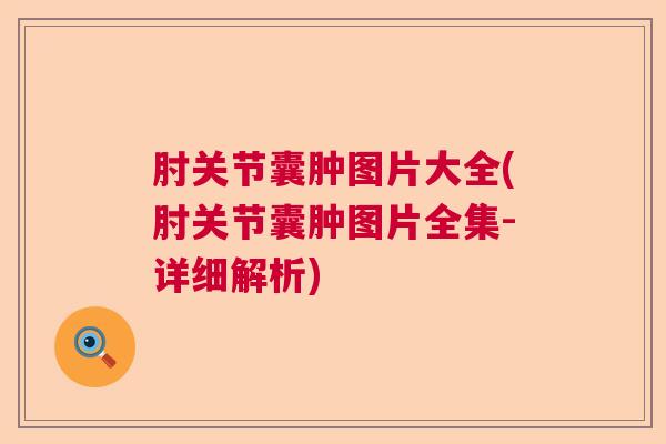 肘关节囊肿图片大全(肘关节囊肿图片全集-详细解析)