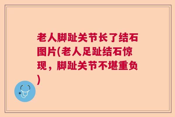 老人脚趾关节长了结石图片(老人足趾结石惊现,脚趾关节不堪重负)