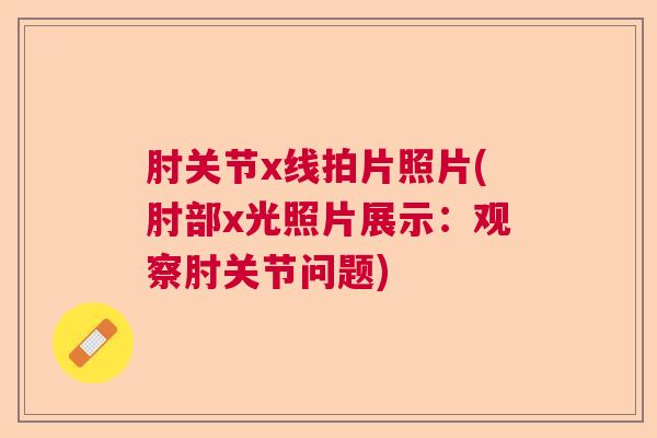 肘关节x线拍片照片(肘部x光照片展示:观察肘关节问题)