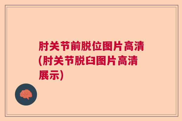 肘关节前脱位图片高清(肘关节脱臼图片高清展示)