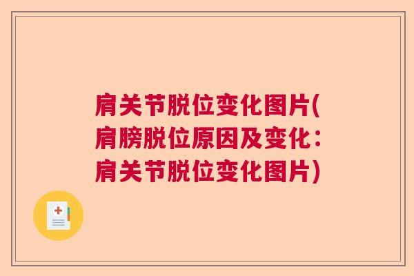 肩关节脱位变化图片(肩膀脱位原因及变化：肩关节脱位变化图片)