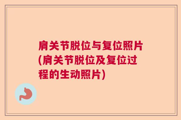 肩关节脱位与复位照片(肩关节脱位及复位过程的生动照片)