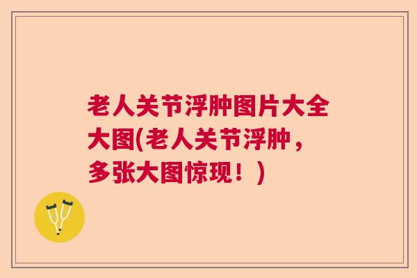 老人关节浮肿图片大全大图(老人关节浮肿，多张大图惊现！)