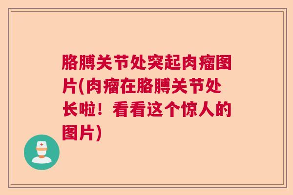 胳膊关节处突起肉瘤图片(肉瘤在胳膊关节处长啦!看看这个惊人的图片) 胳膊关节处突起肉瘤图片(肉瘤在胳膊关节处长啦!看看这个惊人的图片)