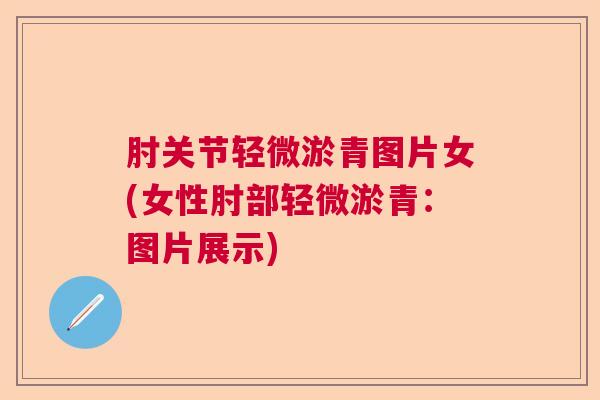 肘关节轻微淤青图片女(女性肘部轻微淤青:图片展示)