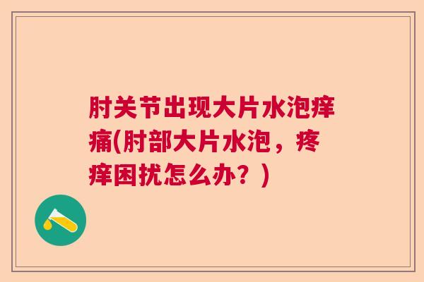 肘关节出现大片水泡痒痛(肘部大片水泡，疼痒困扰怎么办？)