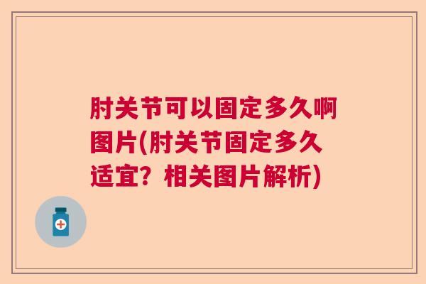 肘关节可以固定多久啊图片(肘关节固定多久适宜?相关图片解析)