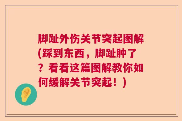 脚趾外伤关节突起图解(踩到东西,脚趾肿了?看看这篇图解教你如何缓解关节突起!) 脚趾外伤关节突起图解(踩到东西,脚趾肿了?看看这篇图解教你如何缓解关节突起!)