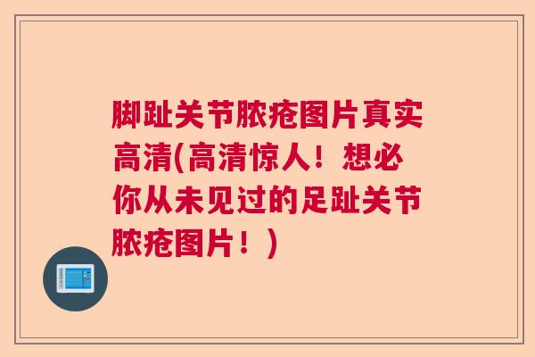 脚趾关节脓疮图片真实高清(高清惊人！想必你从未见过的足趾关节脓疮图片！)