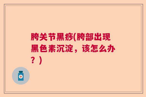 胯关节黑痧(胯部出现黑色素沉淀,该怎么办?) 胯关节黑痧(胯部出现黑色素沉淀,该怎么办?)
