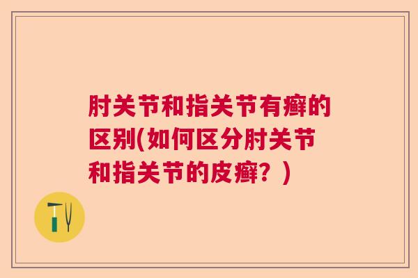 肘关节和指关节有癣的区别(如何区分肘关节和指关节的皮癣?)