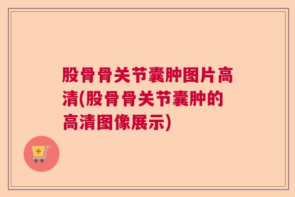 股骨骨关节囊肿图片高清(股骨骨关节囊肿的高清图像展示)