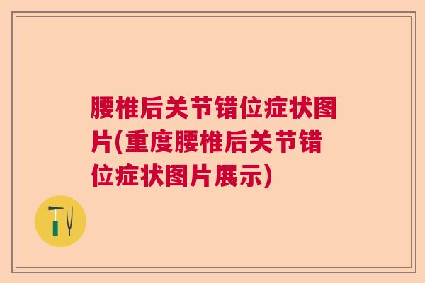 腰椎后关节错位症状图片(重度腰椎后关节错位症状图片展示)