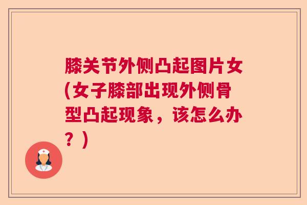 膝关节外侧凸起图片女(女子膝部出现外侧骨型凸起现象,该怎么办?) 膝关节外侧凸起图片女(女子膝部出现外侧骨型凸起现象,该怎么办?)