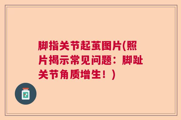 脚指关节起茧图片(照片揭示常见问题:脚趾关节角质增生!) 脚指关节起茧图片(照片揭示常见问题:脚趾关节角质增生!)