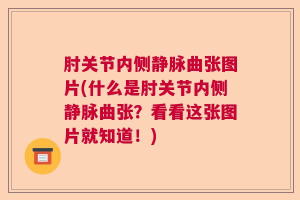 肘关节内侧静脉曲张图片(什么是肘关节内侧静脉曲张?看看这张图片就知道!) 肘关节内侧静脉曲张图片(什么是肘关节内侧静脉曲张?看看这张图片就知道!)