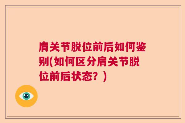 肩关节脱位前后如何鉴别(如何区分肩关节脱位前后状态?) 肩关节脱位前后如何鉴别(如何区分肩关节脱位前后状态?)