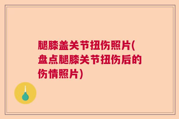 腿膝盖关节扭伤照片(盘点腿膝关节扭伤后的伤情照片)