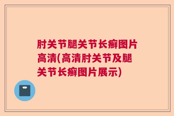 肘关节腿关节长癣图片高清(高清肘关节及腿关节长癣图片展示) 肘关节腿关节长癣图片高清(高清肘关节及腿关节长癣图片展示)
