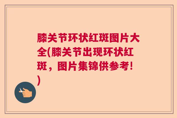 膝关节环状红斑图片大全(膝关节出现环状红斑,图片集锦供参考!) 膝关节环状红斑图片大全(膝关节出现环状红斑,图片集锦供参考!)