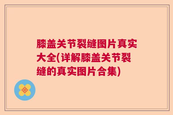 膝盖关节裂缝图片真实大全(详解膝盖关节裂缝的真实图片合集)