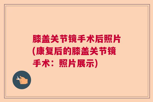 膝盖关节镜手术后照片(康复后的膝盖关节镜手术：照片展示)