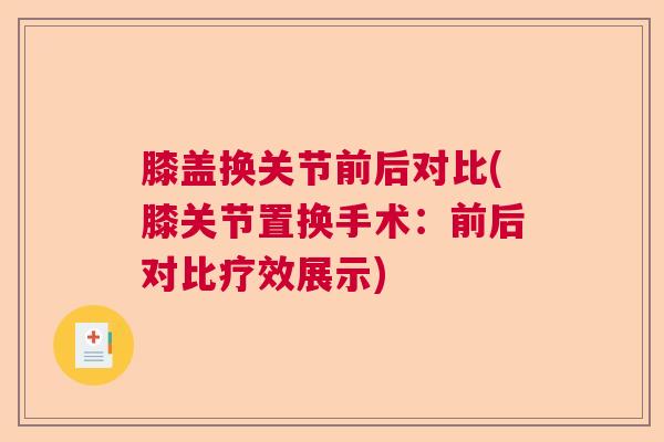 膝盖换关节前后对比(膝关节置换手术：前后对比疗效展示)