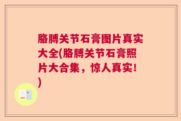 胳膊关节石膏图片真实大全(胳膊关节石膏照片大合集,惊人真实!) 胳膊关节石膏图片真实大全(胳膊关节石膏照片大合集,惊人真实!)
