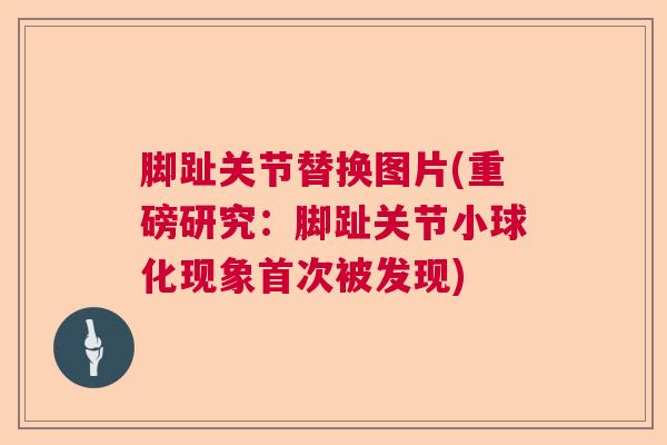 脚趾关节替换图片(重磅研究：脚趾关节小球化现象首次被发现)