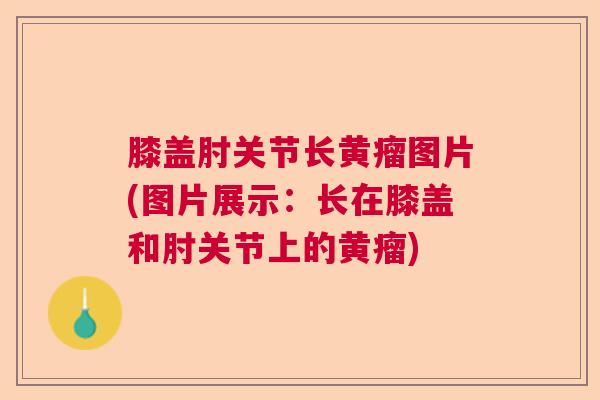 膝盖肘关节长黄瘤图片(图片展示：长在膝盖和肘关节上的黄瘤)