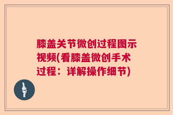 膝盖关节微创过程图示视频(看膝盖微创手术过程:详解操作细节) 膝盖关节微创过程图示视频(看膝盖微创手术过程:详解操作细节)