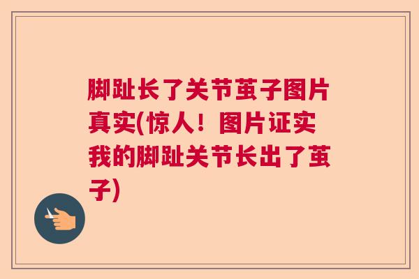 脚趾长了关节茧子图片真实(惊人!图片证实我的脚趾关节长出了茧子)