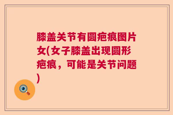 膝盖关节有圆疤痕图片女(女子膝盖出现圆形疤痕，可能是关节问题)