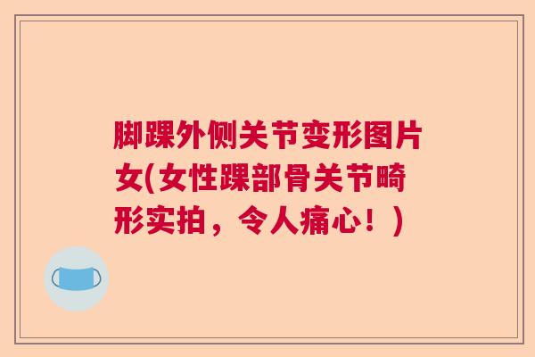 脚踝外侧关节变形图片女(女性踝部骨关节畸形实拍，令人痛心！)