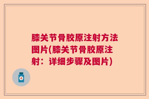 膝关节骨胶原注射方法图片(膝关节骨胶原注射：详细步骤及图片)