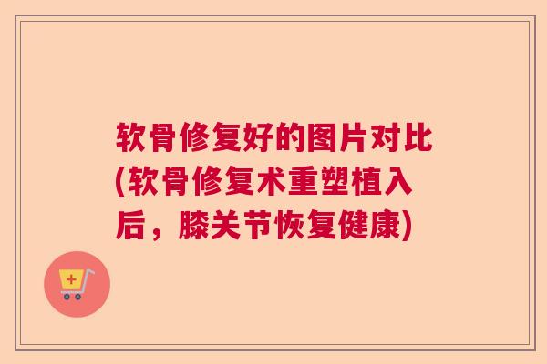 软骨修复好的图片对比(软骨修复术重塑植入后,膝关节恢复健康) 软骨修复好的图片对比(软骨修复术重塑植入后,膝关节恢复健康)