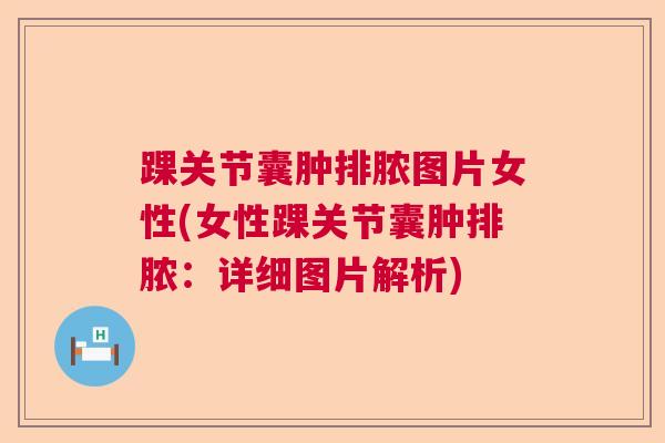踝关节囊肿排脓图片女性(女性踝关节囊肿排脓：详细图片解析)
